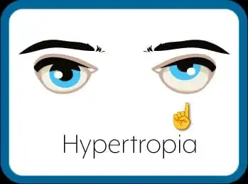 image shows that one eye is elevated as comapre to the other