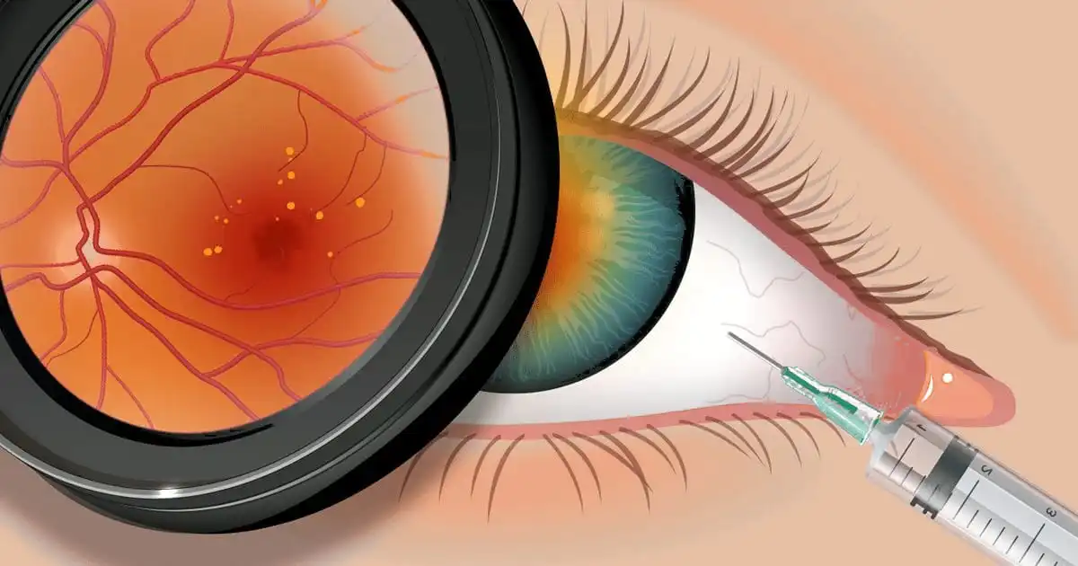 it is time to lower the bar and educate people that every person with glasses is not fit for laser